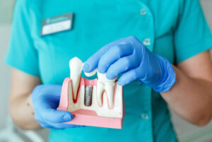 Dental Implant cost explanation south plympton