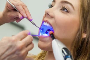 How to Relieve Tooth Pain After Filling prep