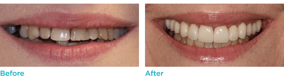 DSD Case