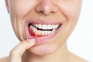 how to fix loose teeth from gum disease gums